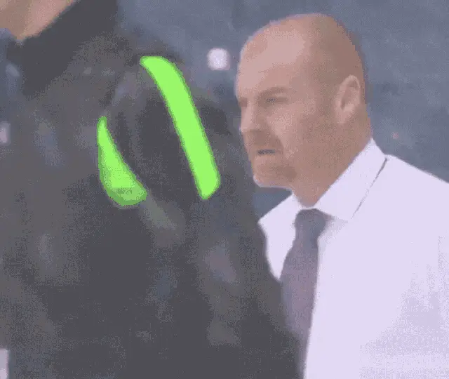 Sean Dyche's Smile