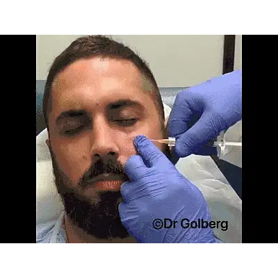 Non-Surgical Facelift & Injections NYC Dr Golberg