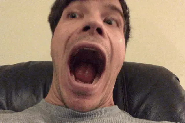 Open Mouth Meme