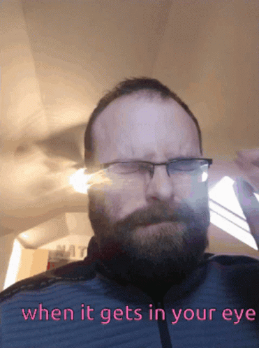 Kitkat Jdog: When It Gets In Your Eye